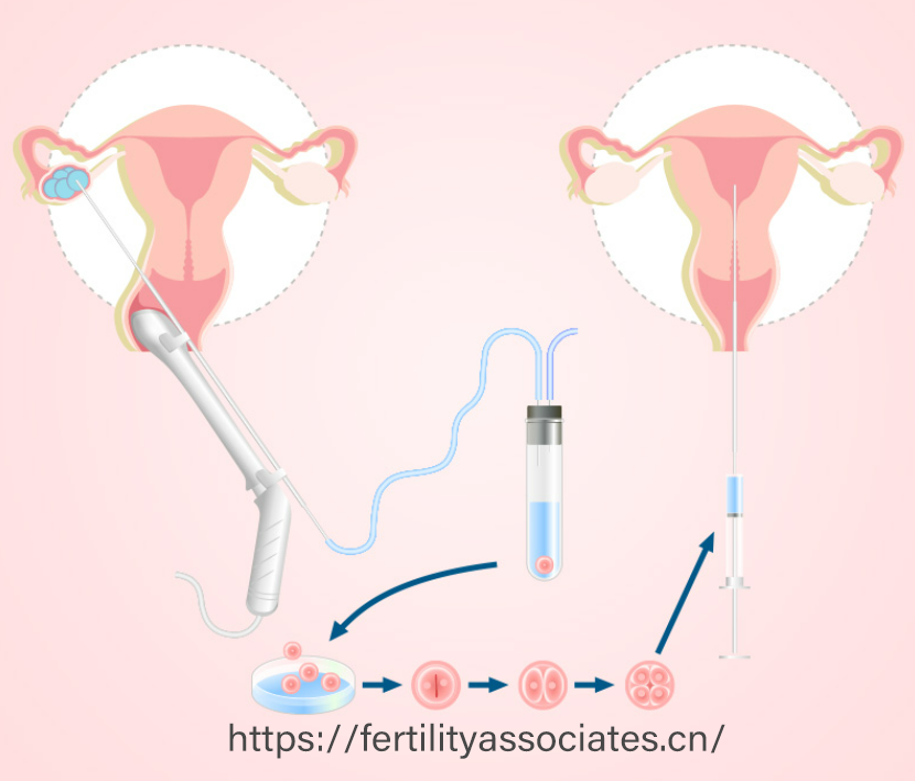 试管婴儿：靠谱性究竟有几分?
